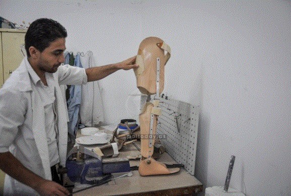 افتتاح أول مركز لتركيب الأطراف الاصطناعية في المنطقة الجنوبية