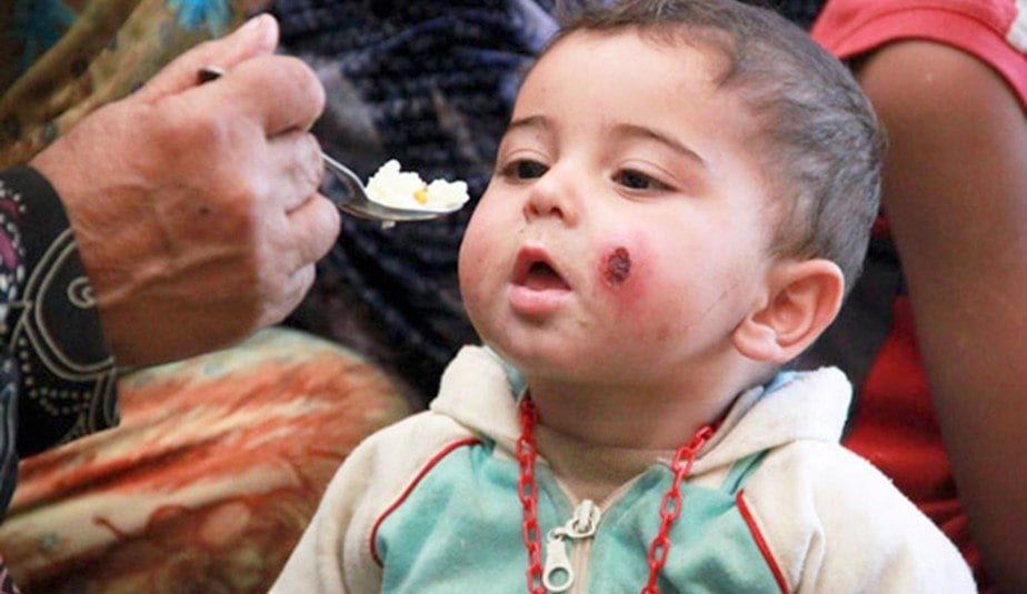 في الأرياف المحاصرة.. هكذا تعيش النساء وتعانين في الحمل والولادة