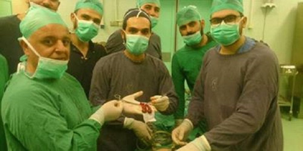 في حالة ناردة…رجل بمرارتين “فقعتا” دفعةً واحدة!