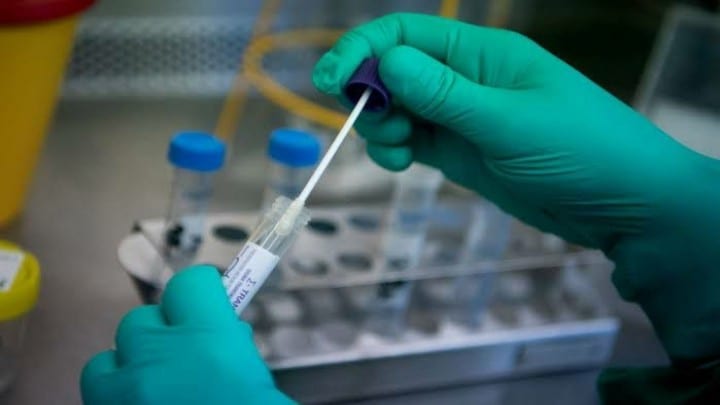 الإعلان عن نتائج فحص الحالات المشتبه بإصابتها بفيروس كورونا في إدلب