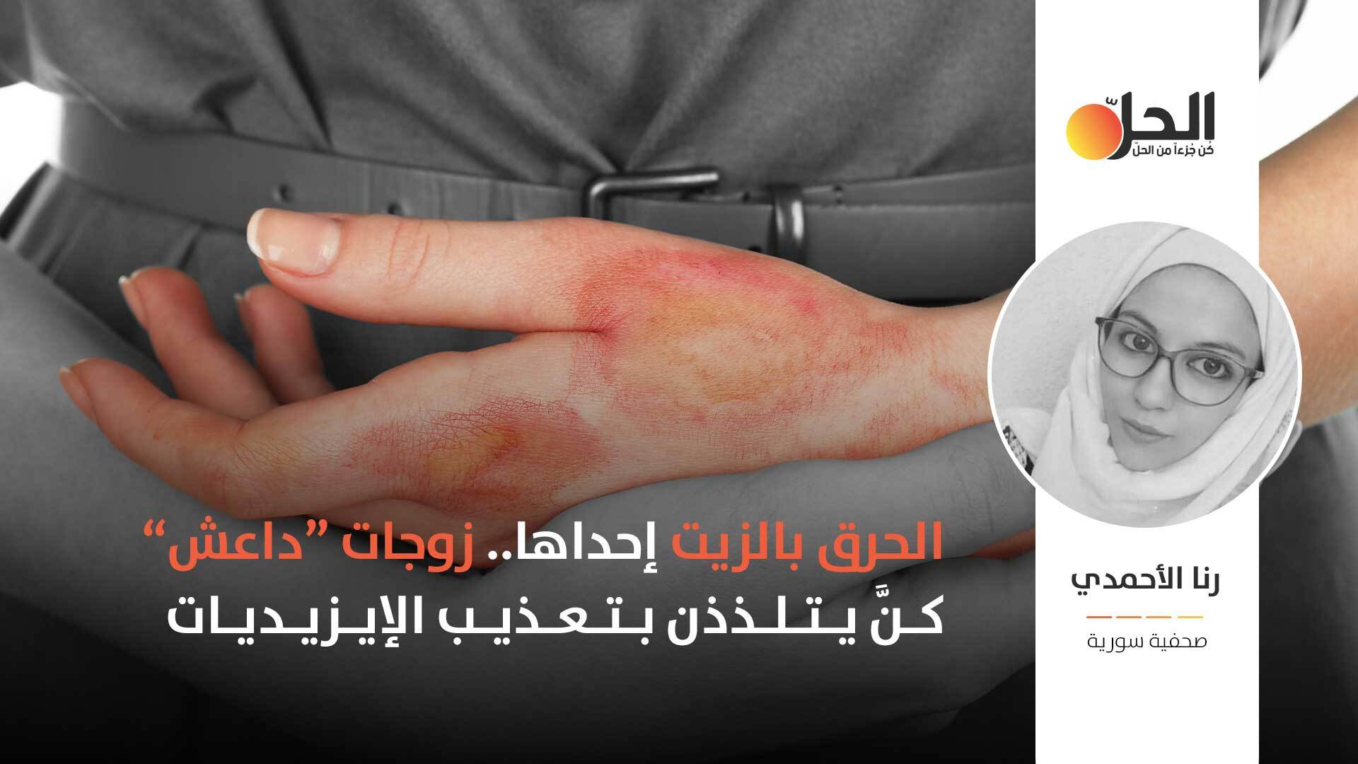 مأساةٌ مزدوجة للمختطفات الإيزيديّات.. استعبادٌ جنسي ثم انتقام زوجات «داعش»