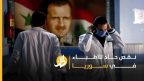 نقص حاد للأطباء في سوريا