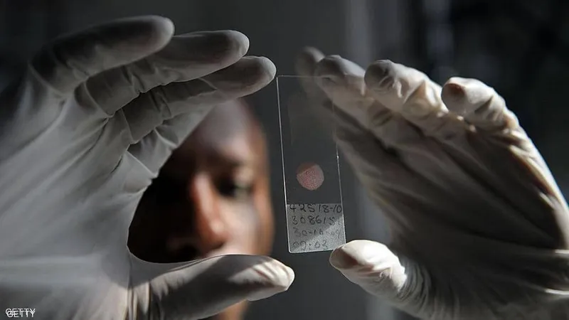 عدة صعوبات تعترض تطوير لقاح ضد الملاريا - إنترنت