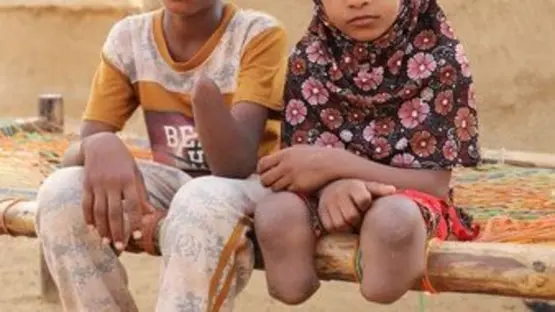 في منزل متواضع بحي الجمهوري في مدينة تعز، جنوب غربي اليمن، تجلس "قبول حمود عبد القادر"، غير قادرة على الحركة، امرأة ستينية أنهكتها حرب جماعة "الحوثي"، وقلبت حياتها رأساً على عقب، بعد أن داست على لغم أرضي، حولها إلى جسد مبتور وروح محطمة. 