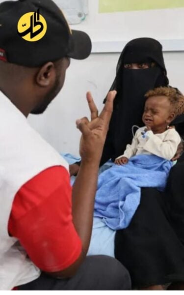 أطباء بلا حدود: قفزة حادة في سوء تغذية أطفال اليمن